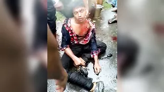 Motorcycle And Car Collision