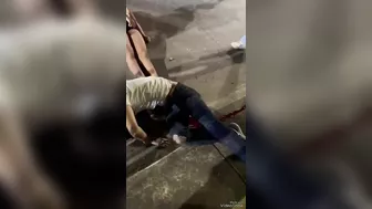 Beautiful Girl And Her Husband Had An Accident On A Motorcycle