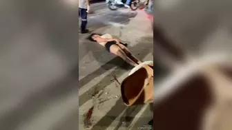 Beautiful Girl And Her Husband Had An Accident On A Motorcycle