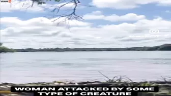 Have You Ever Seen Someone Being Attacked By A Capybara?