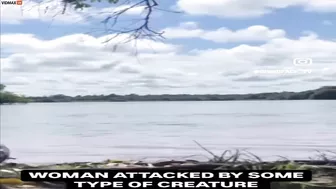 Have You Ever Seen Someone Being Attacked By A Capybara?