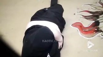 Fat Skater Broke His Balls