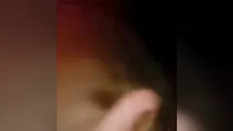 Man's Hand Blown Off By Fireworks