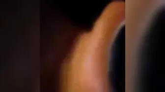 Man's Hand Blown Off By Fireworks