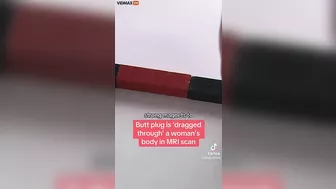 Patient With Metal Sex Toy In Butt Seriously Injured
