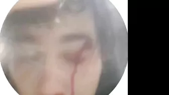 Sudden Loss Of Consciousness