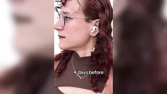 Guy Needs A Refund For His Feminization Surgery