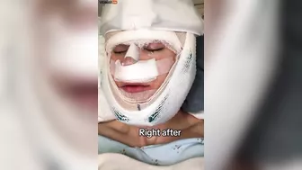 Guy Needs A Refund For His Feminization Surgery