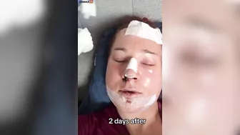 Guy Needs A Refund For His Feminization Surgery