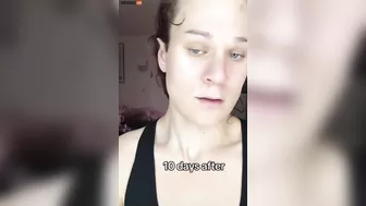 Guy Needs A Refund For His Feminization Surgery