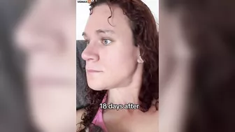 Guy Needs A Refund For His Feminization Surgery