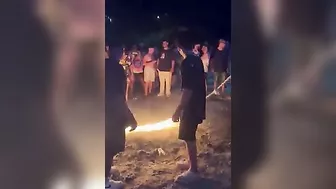 What Can Go Wrong With Skipping Rope Burns?