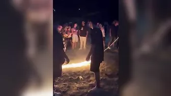 What Can Go Wrong With Skipping Rope Burns?