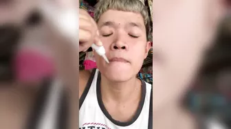 Idiot Superglue's Lips Shut To Get Likes Online