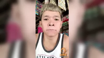 Idiot Superglue's Lips Shut To Get Likes Online